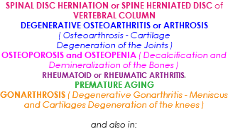 SPINAL DISC HERNIATION or SPINE HERNIATED DISC of VERTEBRAL COLUMN DEGENERATIVE OSTEOARTHRITIS or ARTHROSIS ( Osteoarthrosis - Cartilage Degeneration of the Joints ) OSTEOPOROSIS and OSTEOPENIA ( Decalcification and Demineralization of the Bones ) RHEUMATOID or RHEUMATIC ARTHRITIS. PREMATURE AGING GONARTHROSIS ( Degenerative Gonarthritis - Meniscus and Cartilages Degeneration of the knees ) and also in: